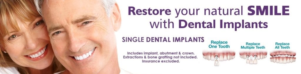 Dental implant procedure
