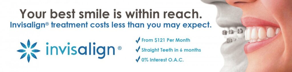 Invisalign clear aligners