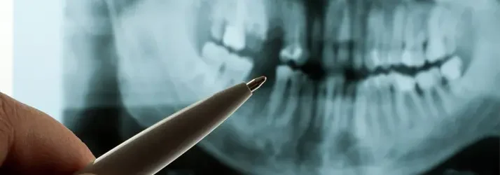 Digital X-ray at My Scottsdale Dentist