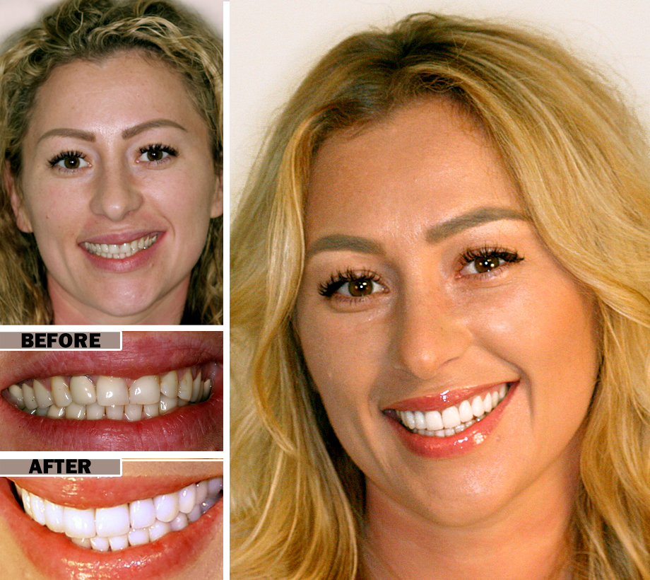 http://myscottsdaledentist.com/wp-content/uploads/2022/02/Cosmetic-Dental-My-Scottsdale-Dentist.png