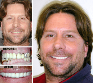 My Scottsdale Dentist Before After